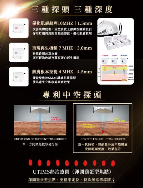 见证年轻：UTIMS音波拉提解决鱼尾纹、抬头 UTIMS音波拉提详解