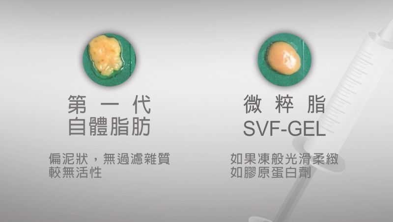 自体脂肪3.0：微粹脂SVF-gel ─ 什么是自体脂肪干细胞 