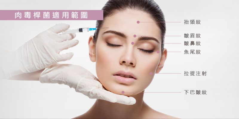 肉毒杆菌素(Botulinum Toxin)一般用于除皱、抬头纹、鱼尾纹、瘦肩