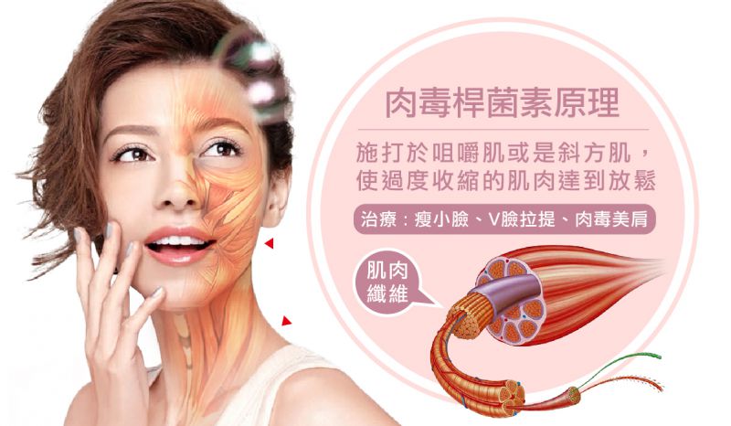 肉毒杆菌素(Botulinum Toxin)一般用于除皱、抬头纹、鱼尾纹、瘦肩