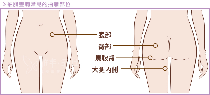 身体哪些部位的脂肪可以抽脂来做自体脂肪丰胸？