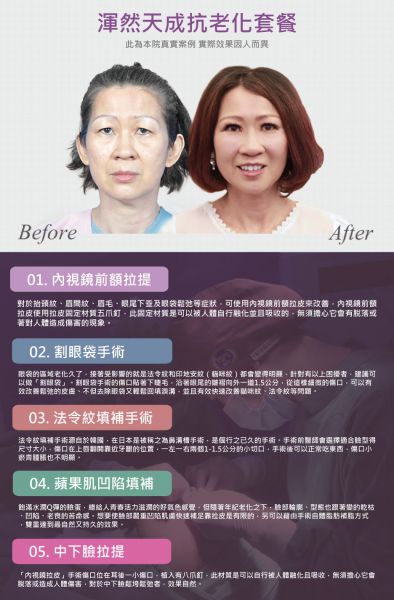 眉毛下垂眼皮下垂眼袋泡鱼尾纹不再年轻怎么办？