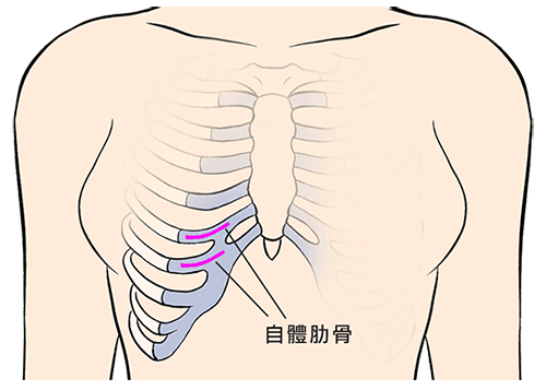 自体耳软骨隆鼻取出方法和切口位置在哪里？