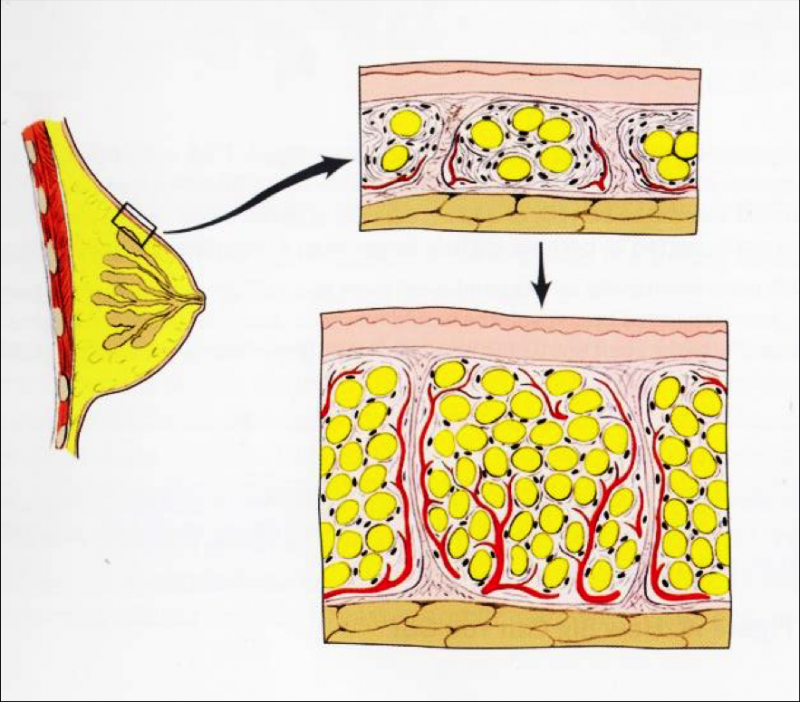 自体脂肪隆胸一次打多少脂肪存活率高？自体脂肪隆胸的原理详解