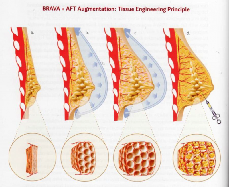 BRAVA波娃是什么？BRAVA波娃的原理简介