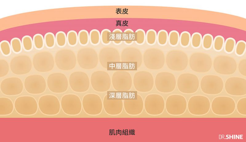 浅层脂肪及深层脂肪那种更容易控制瘦身减肥？