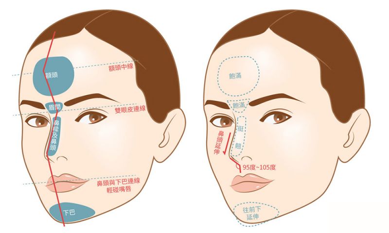 隆鼻就是垫高鼻梁? 鼻型「越高越好」就一定漂亮吗?