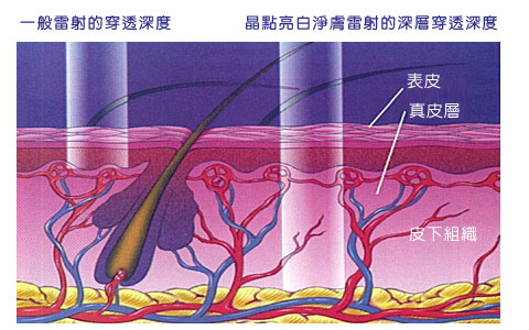 晶点亮白雷射有哪些优点？晶点亮白雷射疗程内容有哪些？