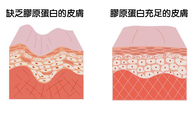 舒颜萃（3D聚左旋乳酸）维持时间多久？舒颜萃（3D聚左旋乳酸）多久注射一次？