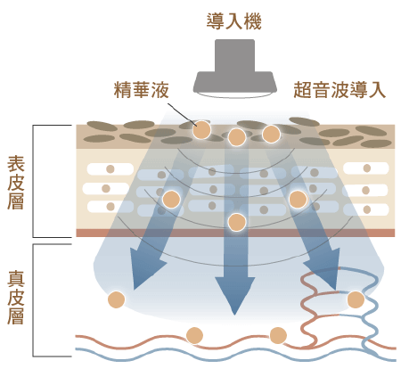 什么是超音波导入？什么是左旋维他命C导入？