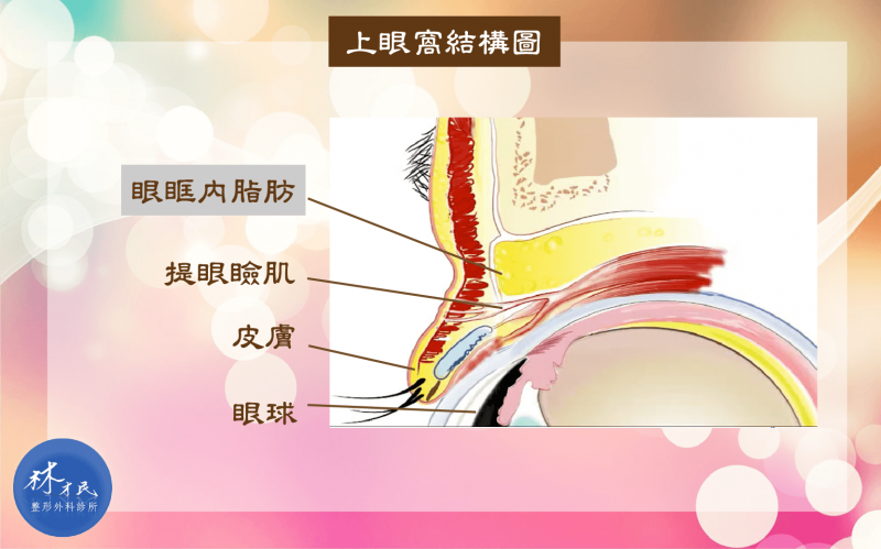 眼窝凹陷原因是什么？脂肪填充眼窝效果怎么样？