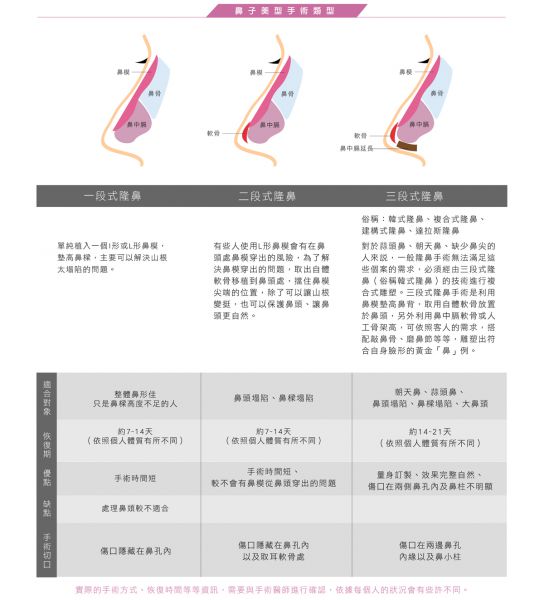 缩鼻头缩鼻翼几天消肿？恢复期多久？怎样测量出自己的黄金「鼻」例？