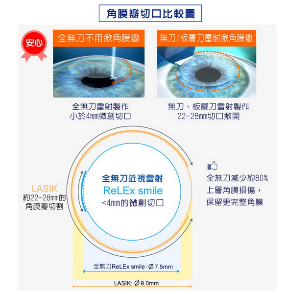 ReLEx smile近视全飞秒激光快速知识库（近视全飞秒激光真实案例）